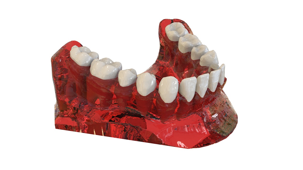 서울 용산구 용산동2가 임플란트 치과 추천