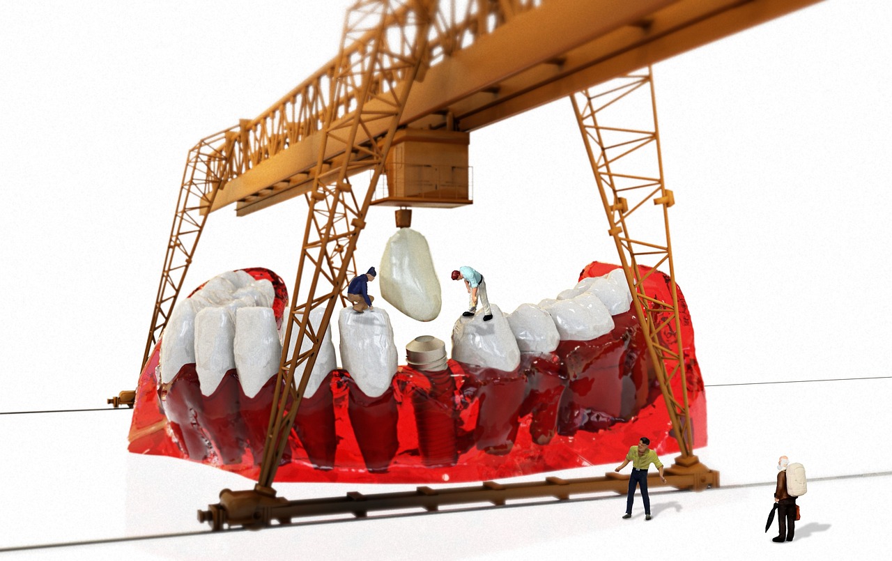 서울 강서구 과해동 임플란트 치과 추천